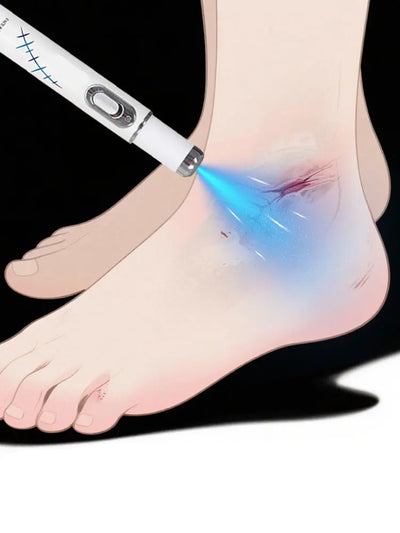 Blue Light Pen For Scars